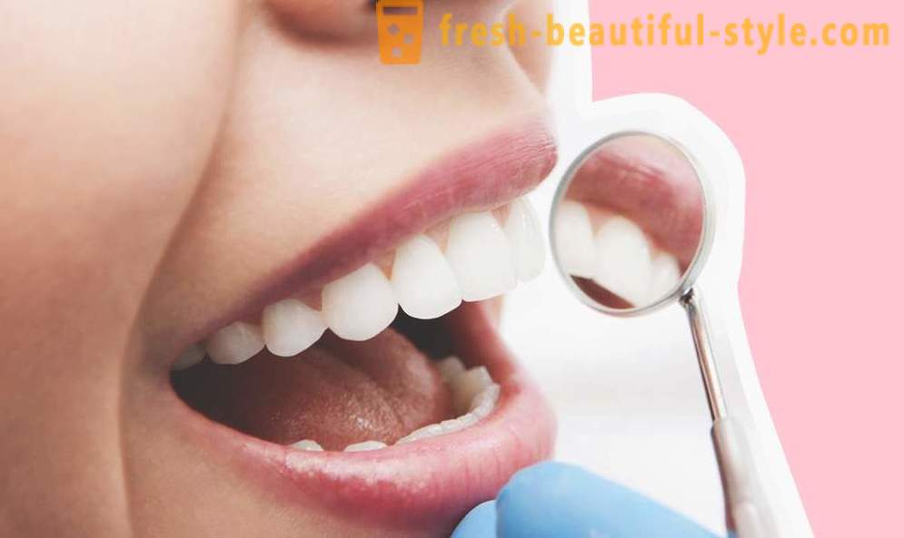 4 mga katanungan tungkol sa dental implants