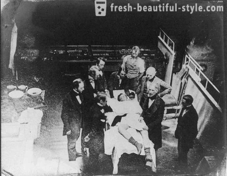 Kasindak-sindak na mga katotohanan tungkol sa Victorian surgery