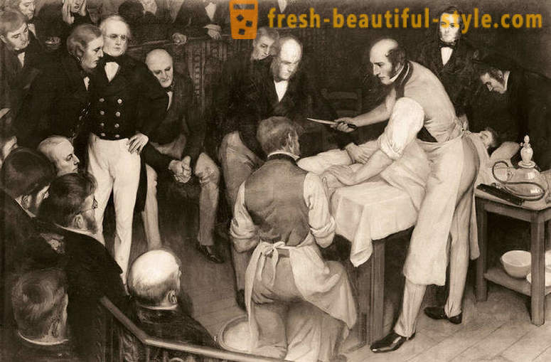 Kasindak-sindak na mga katotohanan tungkol sa Victorian surgery