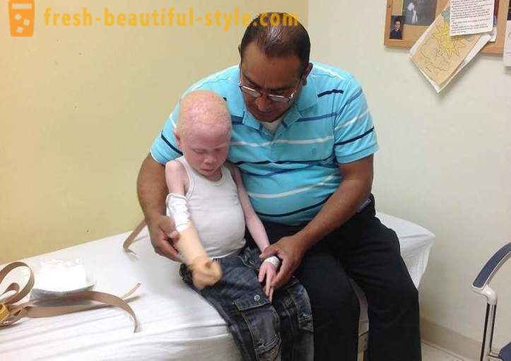 Ang kalunus-lunos na kasaysayan ng Tanzanian albinos