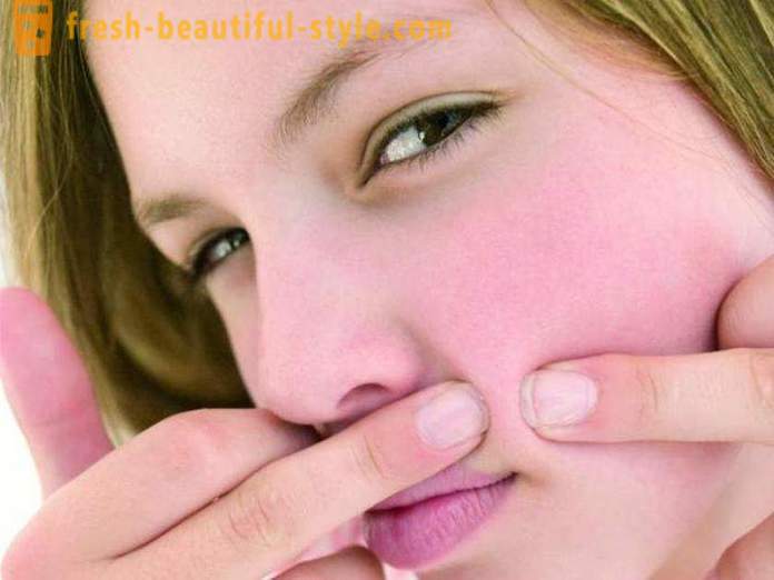 Paano mag-alis pimples: Tips